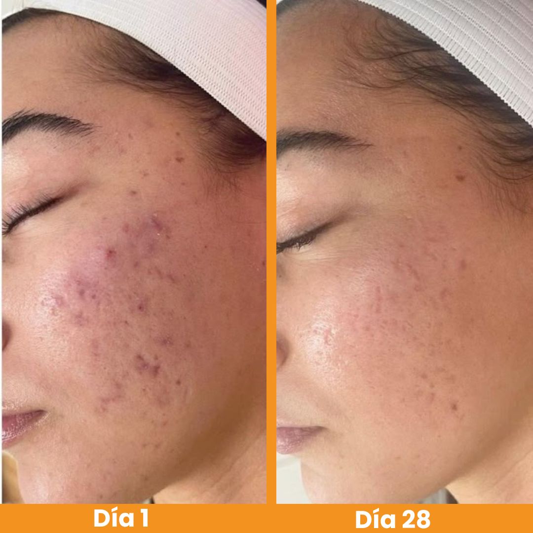 Menos manchas,más confianza rutina anti manchas 3 en 1