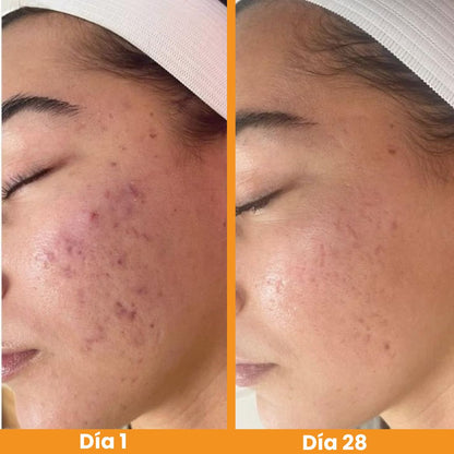 Menos manchas,más confianza rutina anti manchas 3 en 1