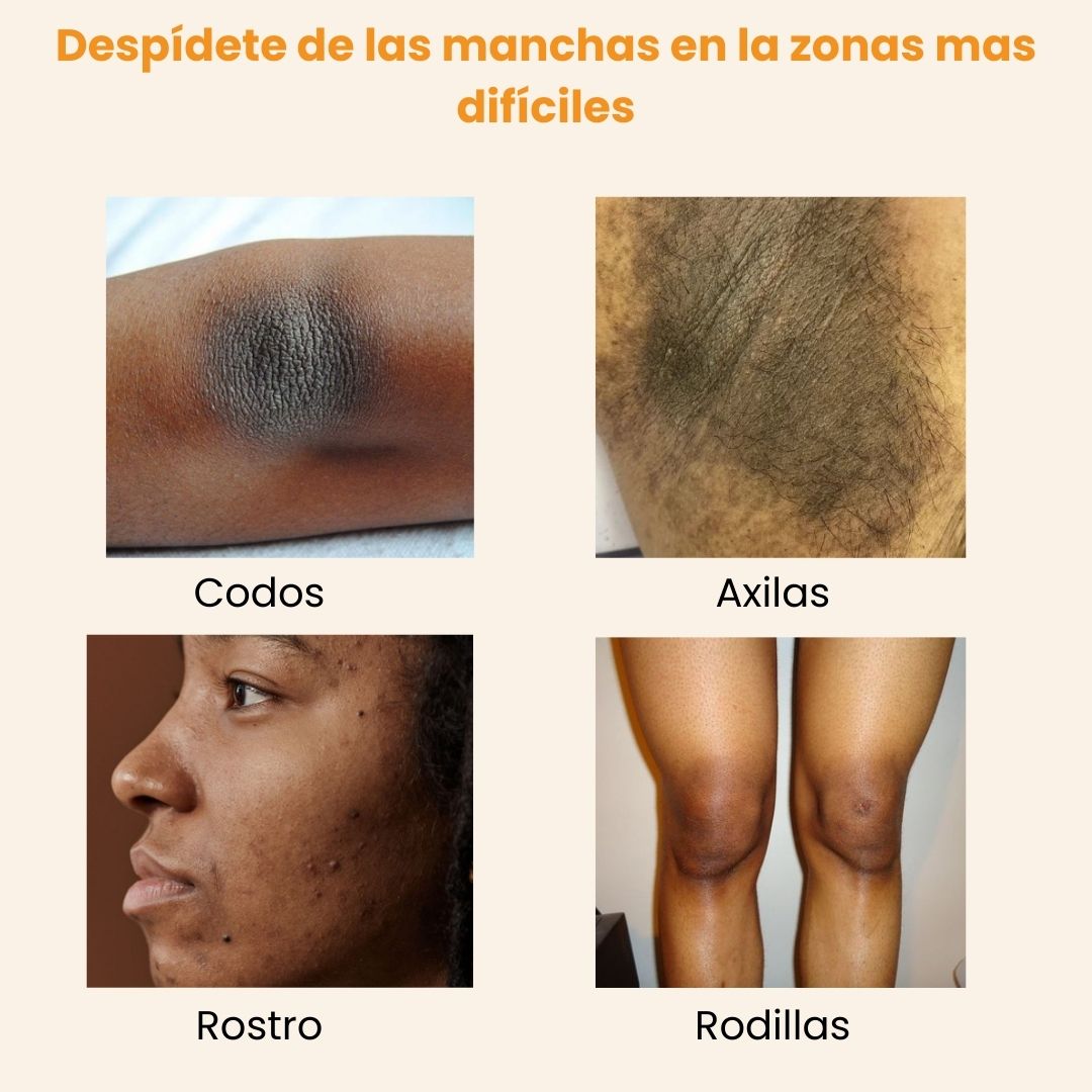 Menos manchas,más confianza rutina anti manchas 3 en 1